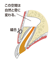 この空間は自然と骨に変わる。