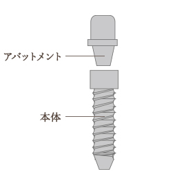 2ピースタイプの特徴