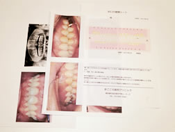検診でお渡しするお口の中の資料